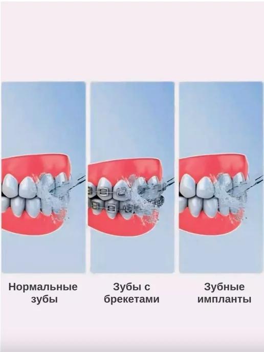 Ирригатор для зубов профессиональный