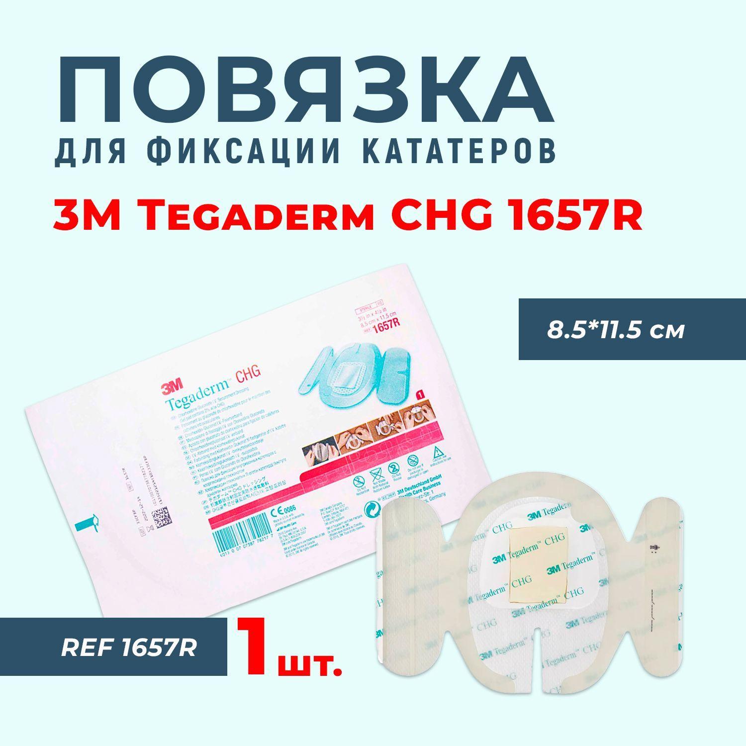 Повязка Tegaderm Тегадерм CHG 1657R для фиксации катетеров с хлоргексидина глюконатом, 8,5x11,5 см, 1 шт