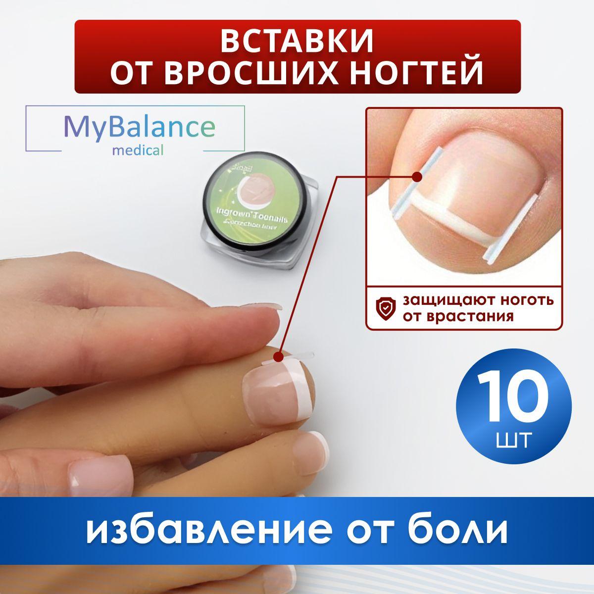 Вставка MyBalance от вросшего ногтя, цвет прозрачный