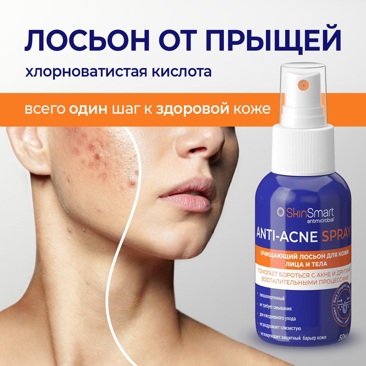 Лосьон от прыщей, хлорноватистая кислота, SkinSmart