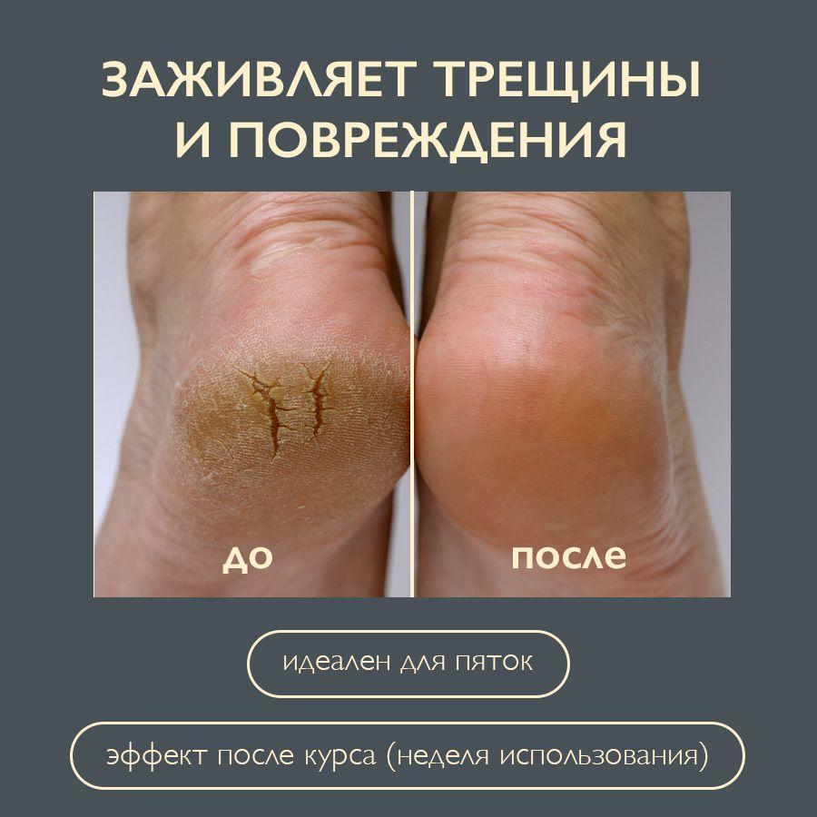 https://cdn1.ozone.ru/s3/multimedia-1-x/7064816037.jpg