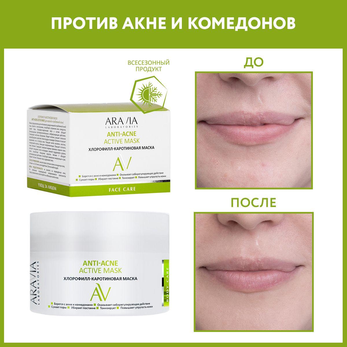 ARAVIA Laboratories Хлорофилл-каротиновая маска ANTI-ACNE ACTIVE MASK, 150 мл