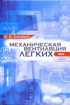 Олег Сатишур: Механическая вентиляция легких