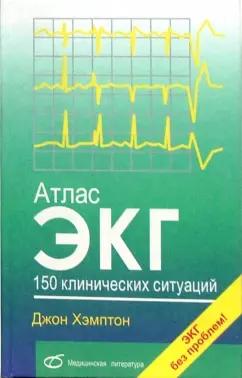 Джон Хэмптон: Атлас ЭКГ. 150 клинических ситуаций