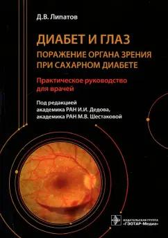 Дмитрий Липатов: Диабет и глаз. Поражение органа зрения при сахарном диабете