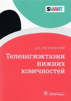 Дмитрий Росуховский: Телеангиэктазии нижних конечностей