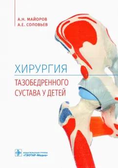 Майоров, Соловьев: Хирургия тазобедренного сустава у детей