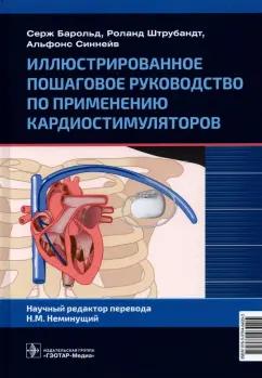 Барольд, Штрубандт, Синнейв: Иллюстрированное пошаговое руководство по применению кардиостимуляторов