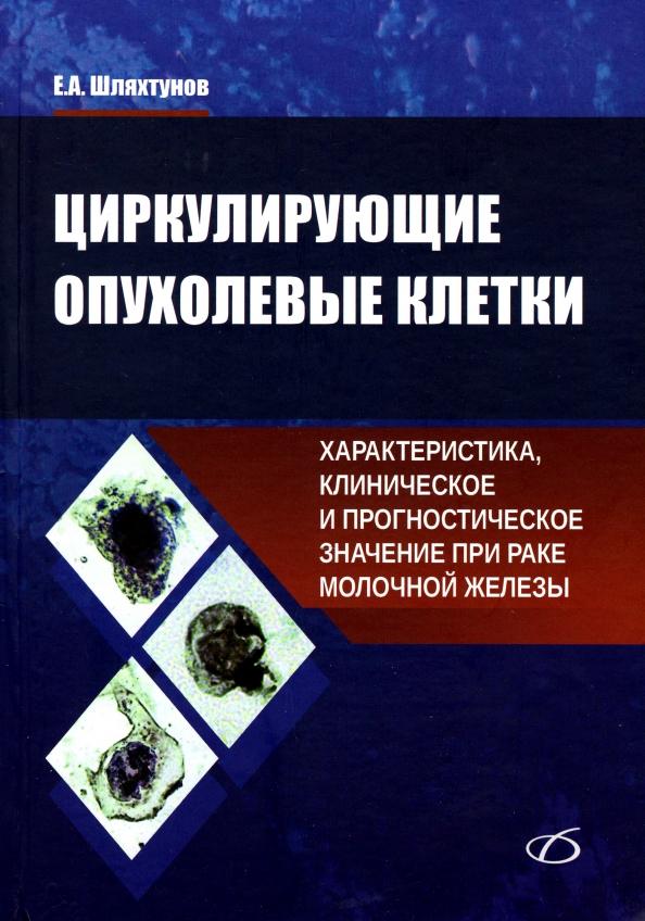 Евгений Шляхтунов: Циркулирующие опухолевые клетки. Характеристика, клиническое и прогностическое значение при раке