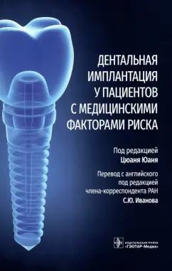 Юань, Чэнь, Дои: Дентальная имплантация у пациентов с медицинскими факторами риска