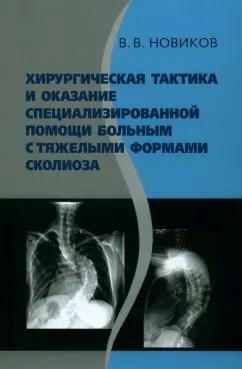 Вячеслав Новиков: Хирургическая тактика и оказание специализированной помощи больным с тяжёлыми формами сколиоза