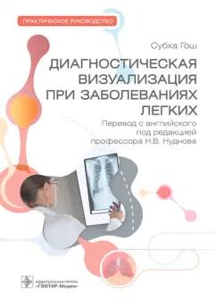 Субха Гош: Диагностическая визуализация при заболеваниях легких. Практическое руководство