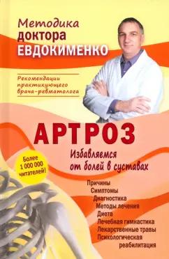 Павел Евдокименко: Артроз. Избавляемся от болей в суставах