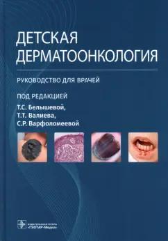 Белышева, Валиев, Варфоломеева: Детская дерматоонкология. Руководство для врачей