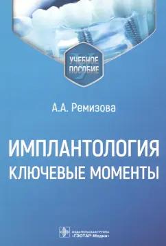 Анна Ремизова: Имплантология. Ключевые моменты. Учебное пособие