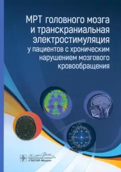 Морозова, Борсуков, Чухонцева: МРТ головного мозга и транскраниальная электростимуляция у пациентов с хроническим нарушением