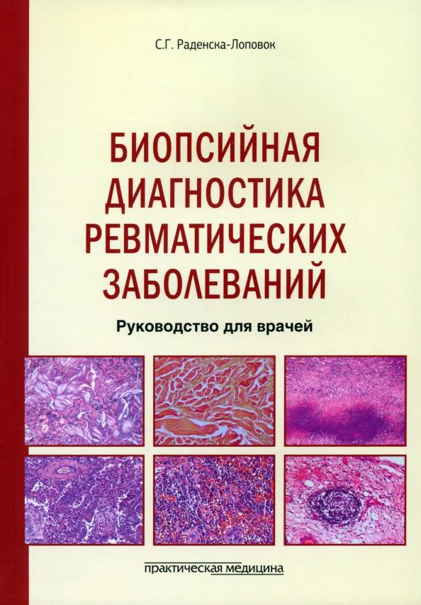 Стефка Раденска-Лоповок: Биопсийная диагностика ревматических заболеваний. Руководство для врачей