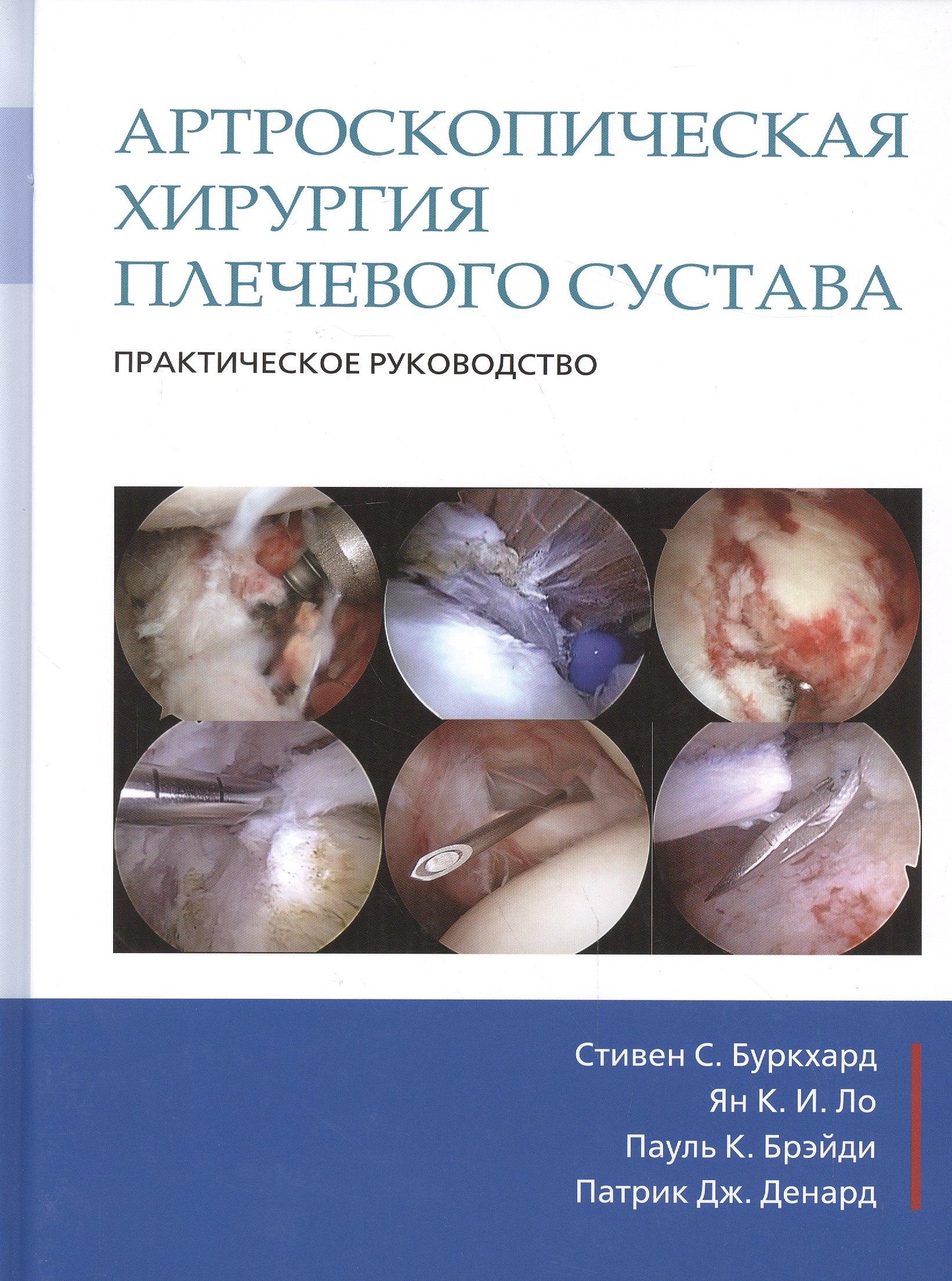 Издательство Панфилова | Артроскопическая хирургия плечевого сустава. Практическое руководство