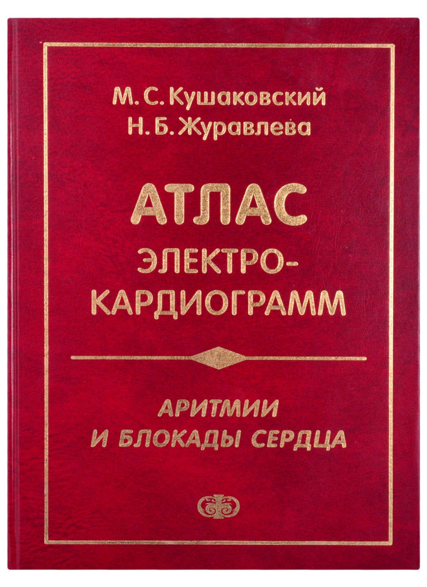 Фолиант | Атлас электрокардиограмм. Аритмии и блокады сердца