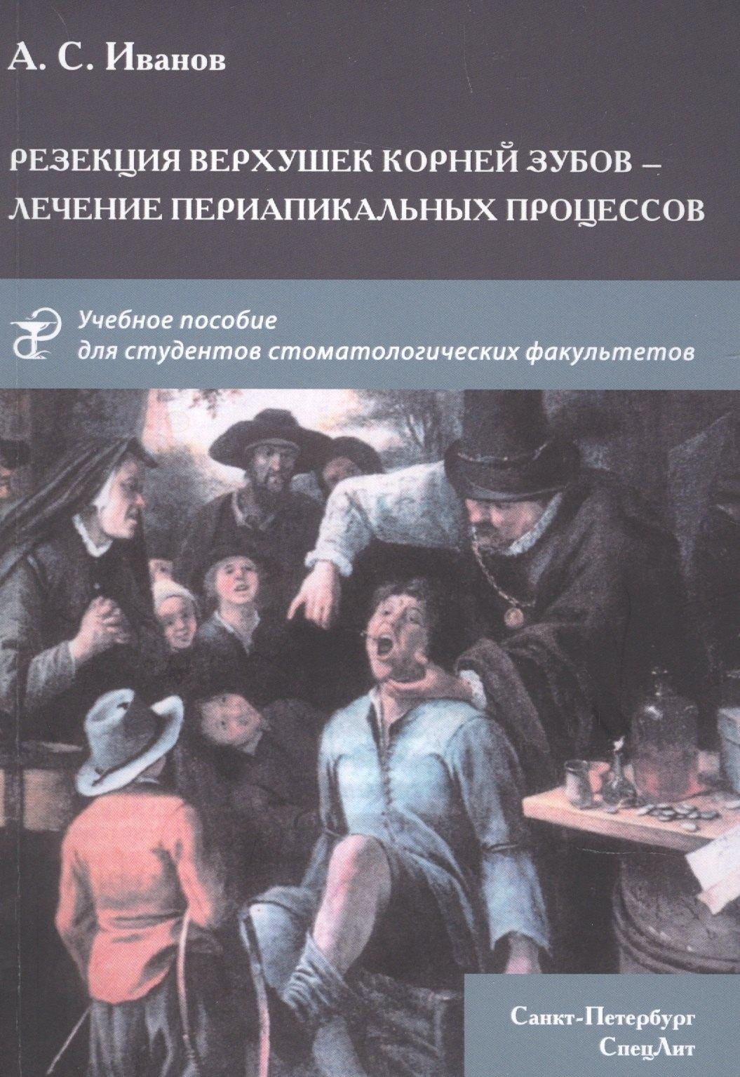 СпецЛит | Резекция верхушек корней зубов - лечение периапикальных процессов