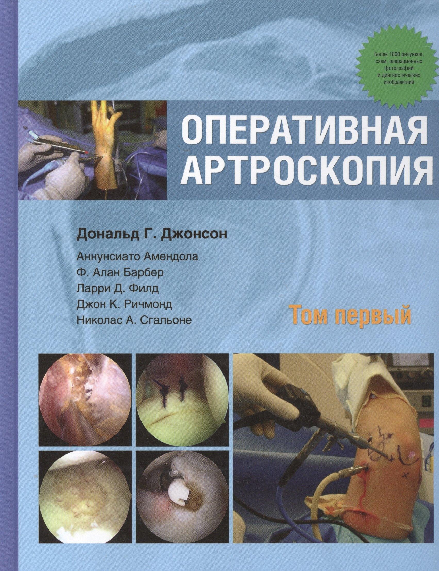 Издательство Панфилова | Оперативная артроскопия. Т. 1
