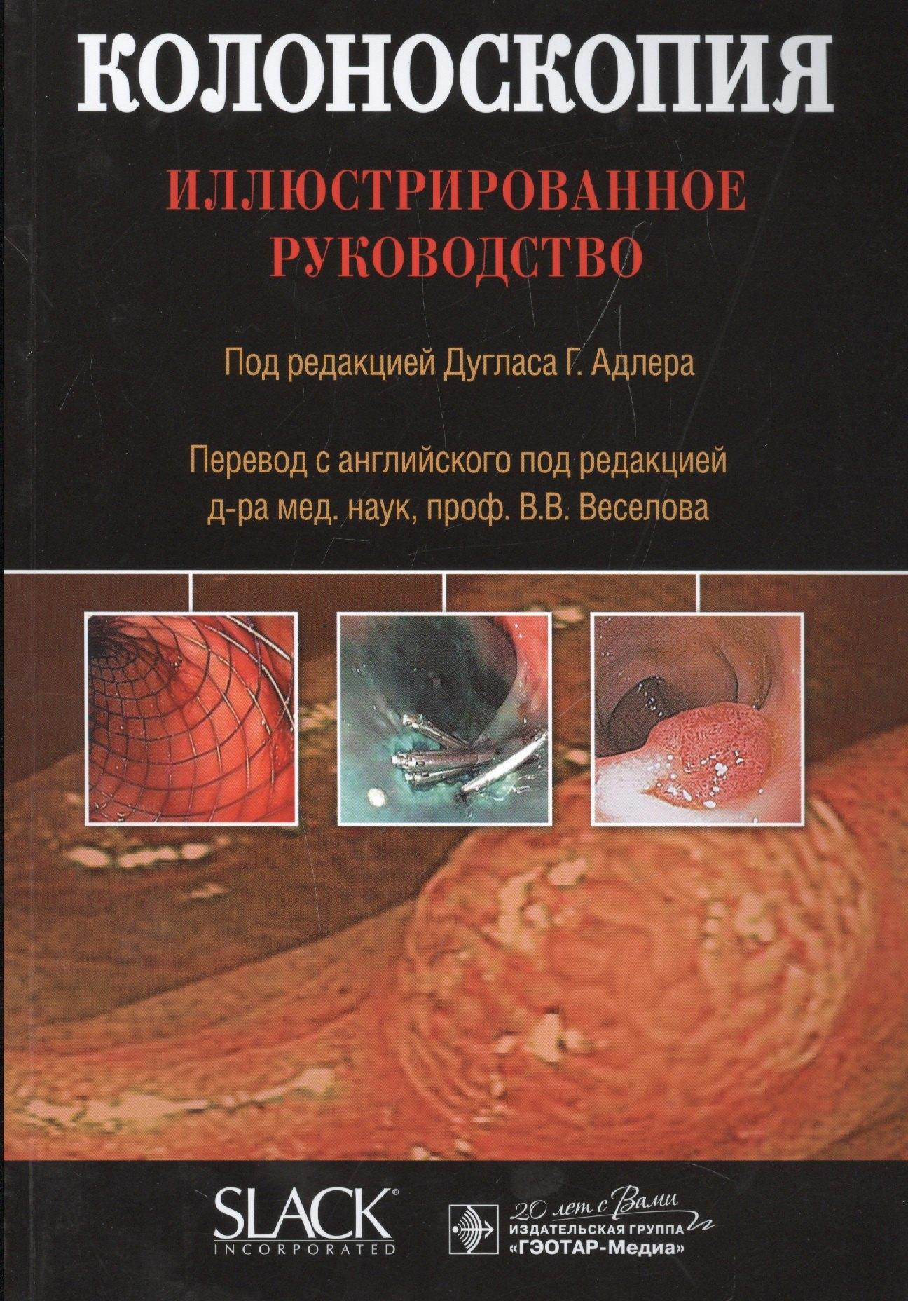 Гэотар-Медиа | Колоноскопия