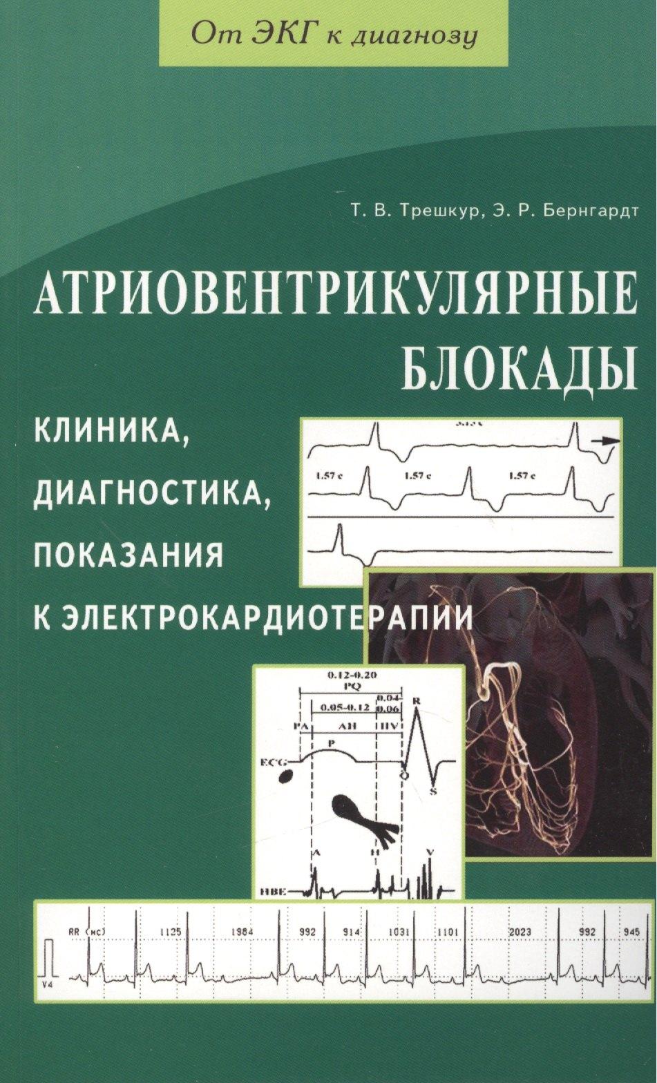 Деметра | Атриовентрикулярные блокады. Клиника, диагностика, показания к электрокардиотерапии