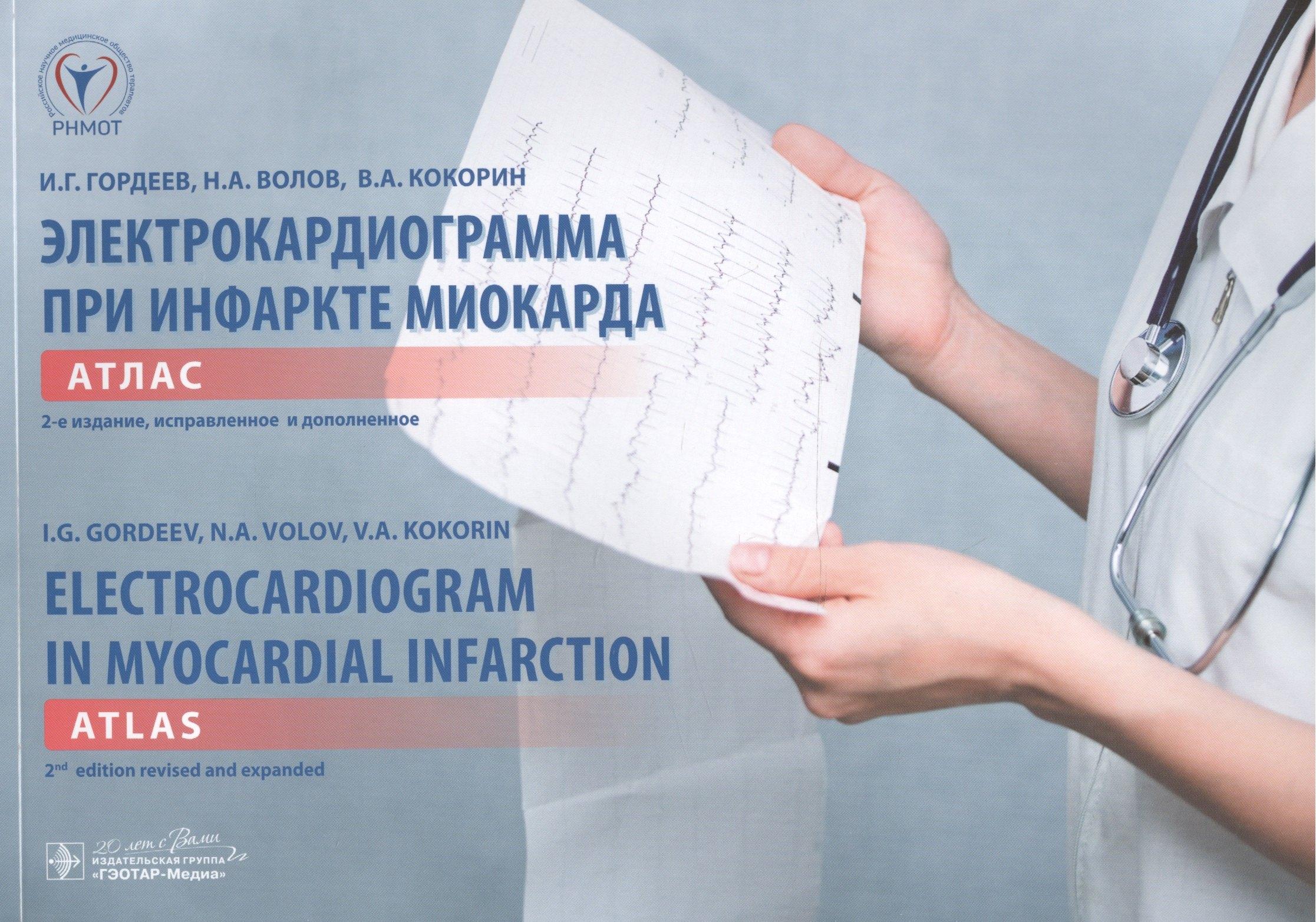 Электрокардиограмма при инфаркте миокарда: атлас на рус. и англ. яз. + вкладыш: линейка электрокардиографическая / 2-е изд., испр. и доп.