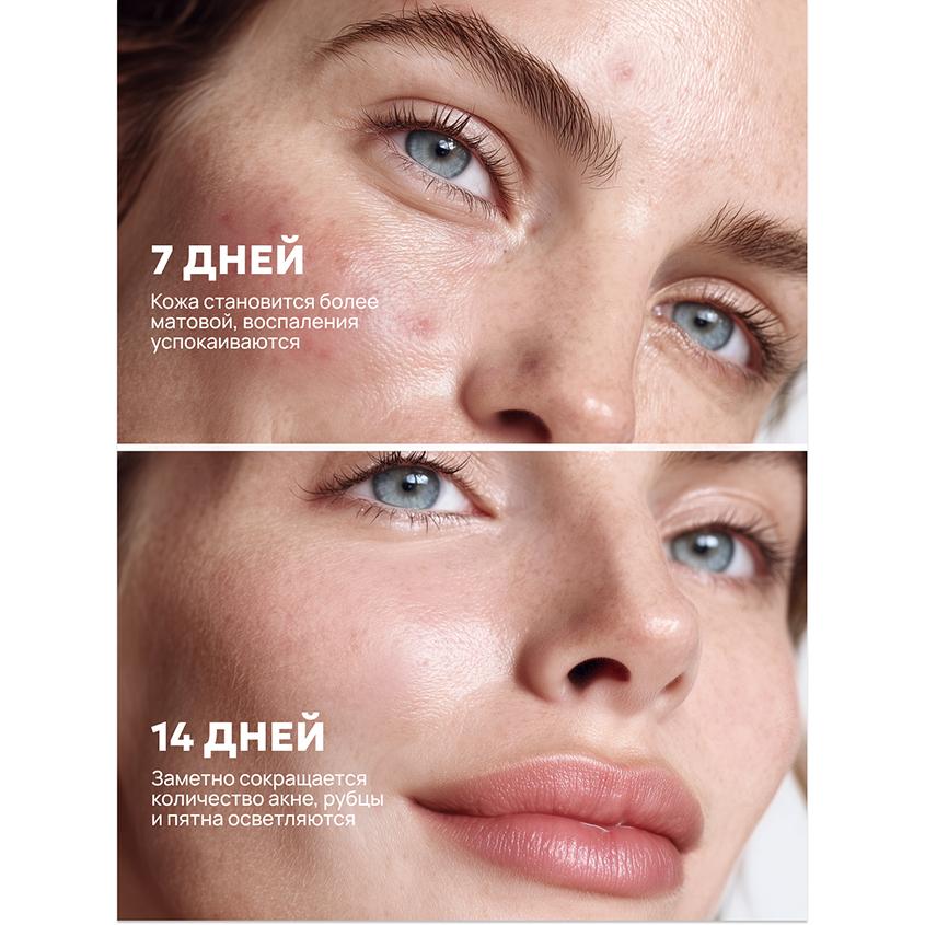 https://www.podrygka.ru/upload/iblock/3f9/26cg6dmj3ztgglig3ygo22930h4hedfb.jpg
