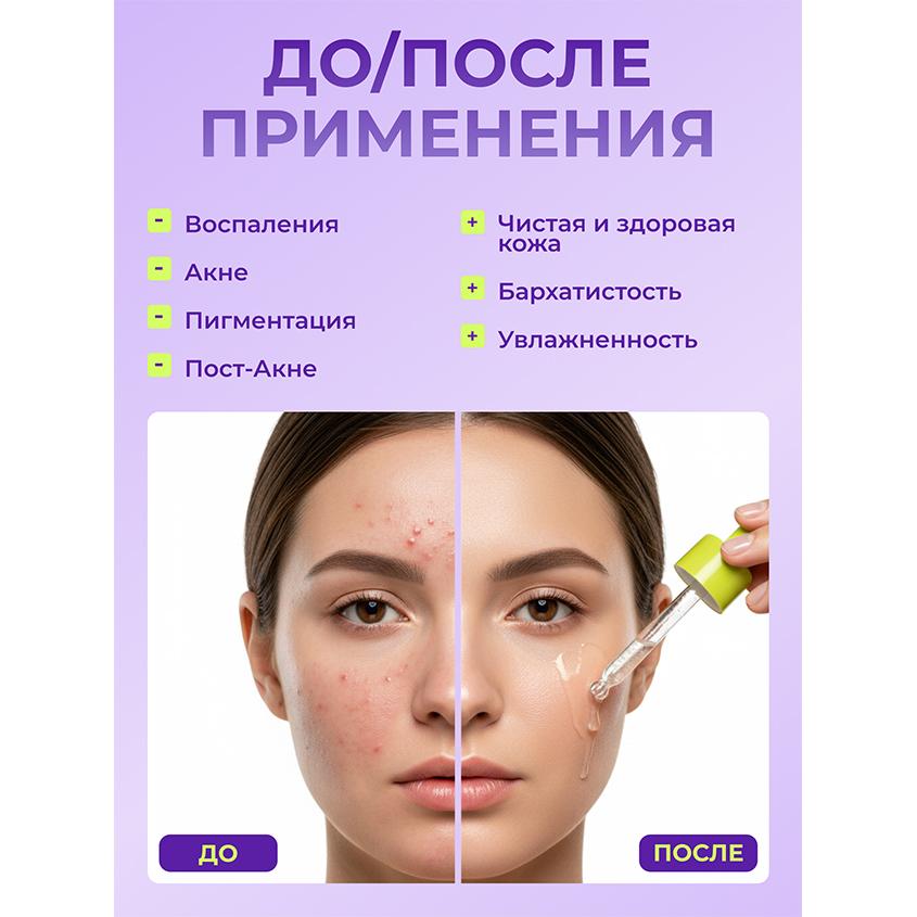 https://www.podrygka.ru/upload/iblock/bf4/bf45870d3376bcd693c1bb7947e703d3.jpg