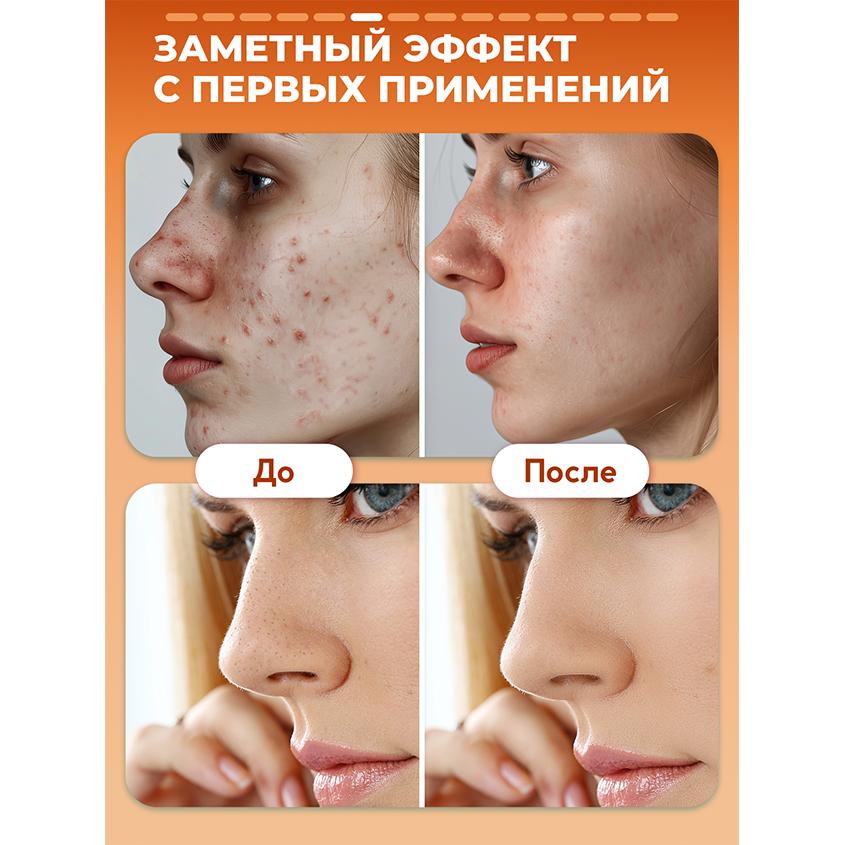 https://www.podrygka.ru/upload/iblock/c49/c4974f80a2cfefc10fa100307244b3a1.jpg
